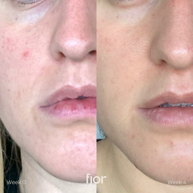 Hydrolytic®️ Serum 30ml, £97