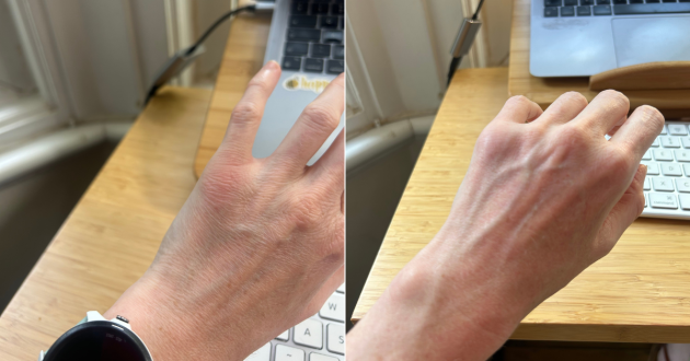 Side-by-side close-ups of the back of Natalie’s hand before and after testing SCULPT PRO