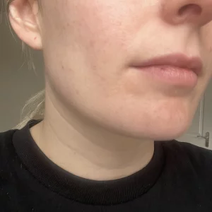 An after view of the CurrentBody LED Red Light Therapy Face Mask: Series 2