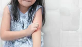 Child with Eczema