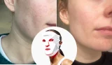 Natasha Gregson tests the CurrentBody LED Red Light Therapy Face Mask Series 2