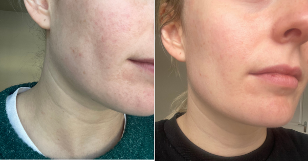 Before and after during testing of the CurrentBody LED Face Mask Series 2