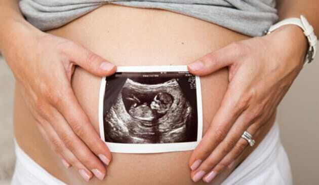 Pregnant belly with picture of baby scan