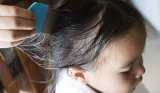Treating head lice
